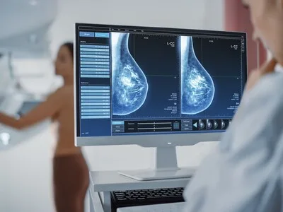 Detectan 113 casos de cáncer de mama mediante programa nacional desde 2021